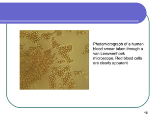 Photomicrograph of a human
blood smear taken through a
van Leeuwenhoek
microscope. Red blood cells
are clearly apparent

12

 