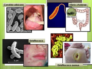 Vibrio cholerae
Estafilococo
Estafilococo aureus
Candida albicans
 