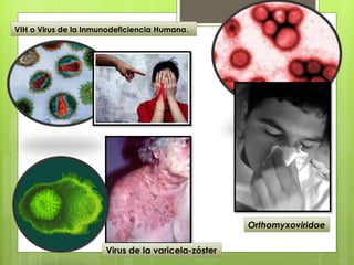 VIH o Virus de la Inmunodeficiencia Humana.
Virus de la varicela-zóster
Orthomyxoviridae
 