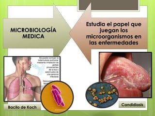 MICROBIOLOGÍA
MEDICA
Estudia el papel que
juegan los
microorganismos en
las enfermedades
Bacilo de Koch
Candidiasis
 
