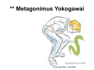 ** Metagonimus Yokogawai
 