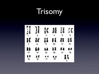 Trisomy
 