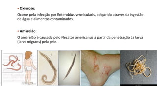▪ Oxiurose:
Ocorre pela infecção por Enterobius vermicularis, adquirido através da ingestão
de água e alimentos contaminados.
▪ Amarelão:
O amarelão é causado pelo Necator americanus a partir da penetração da larva
(larva migrans) pela pele.
 