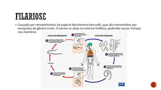 ▪ Causado por nematelmintos da espécie Wuchereria bancrofti, que são transmitidos por
mosquitos do gênero Culex. O verme se aloja no sistema linfático, podendo causar inchaço
nos membros.
 