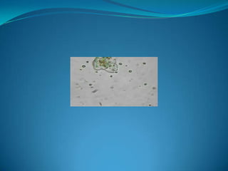 Microb