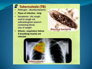 Microb