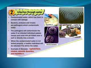 Microb
