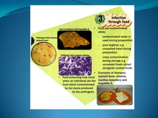 Microb