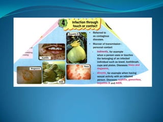 Microb