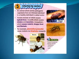 Microb