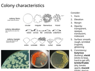 Comprehensive Guide to Microbial Colony Characteristics and ...
