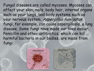 Fungal diseases are called mycoses. Mycoses can affect your skin, nails, body hair, internal organs such as your lungs, and body systems such as your nervous system. Aspergillusfumigatusfungi, for example, can cause aspergillosis, a lung disease. Some fungi have made our lives easier. Penicillin and other antibiotics, which can kill harmful bacteria in our bodies, are made from fungi. penicilliumaspergillosis