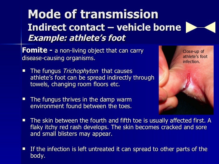 Causes, Symptoms and Methods of Treatment Causes, Symptoms and Methods of Treatment