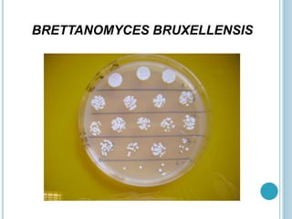 BRETTANOMYCES BRUXELLENSIS
 