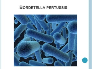 BORDETELLA PERTUSSIS
 