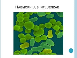 HAEMOPHILUS INFLUENZAE
 