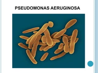 PSEUDOMONAS AERUGINOSA
 