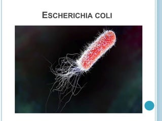 ESCHERICHIA COLI
 