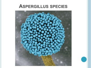 ASPERGILLUS SPECIES
 