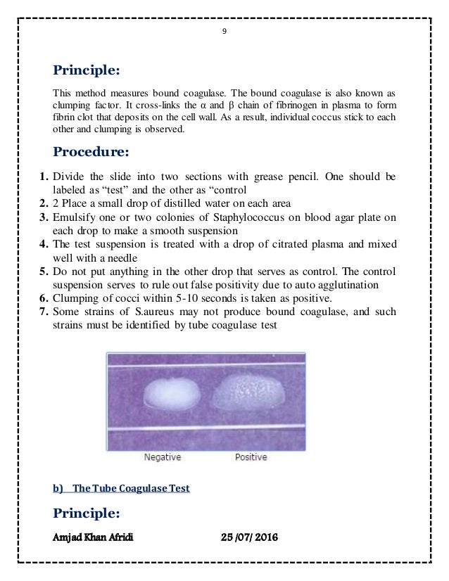 Microbes Isolation From Different Environments