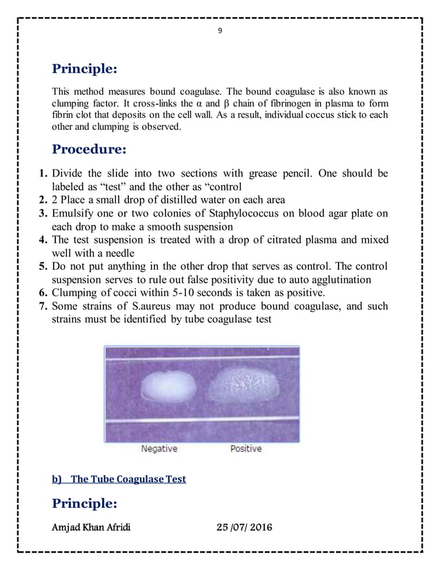 Microbes isolation from different environments