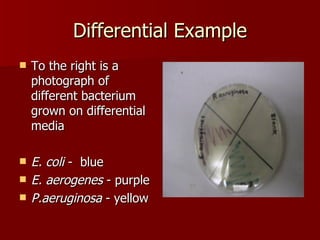 Differential Example To the right is a photograph of different bacterium grown on differential media E. coli  -  blue E. aerogenes  - purple P.aeruginosa  - yellow 