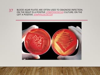 BLOOD AGAR PLATES ARE OFTEN USED TO DIAGNOSE INFECTION.
ON THE RIGHT IS A POSITIVE STREPTOCOCCUS CULTURE; ON THE
LEFT A POSITIVE STAPHYLOCOCCUS
37
 