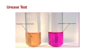 Comprehensive Overview of Microbial Culture Media Types and ...
