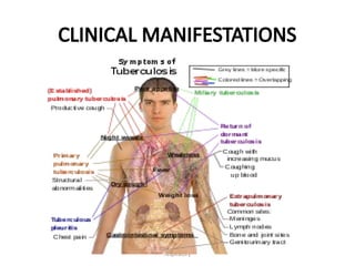 respiratory
CLINICAL MANIFESTATIONS
 