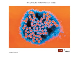 Rhinoviruses, the most common cause of colds
 