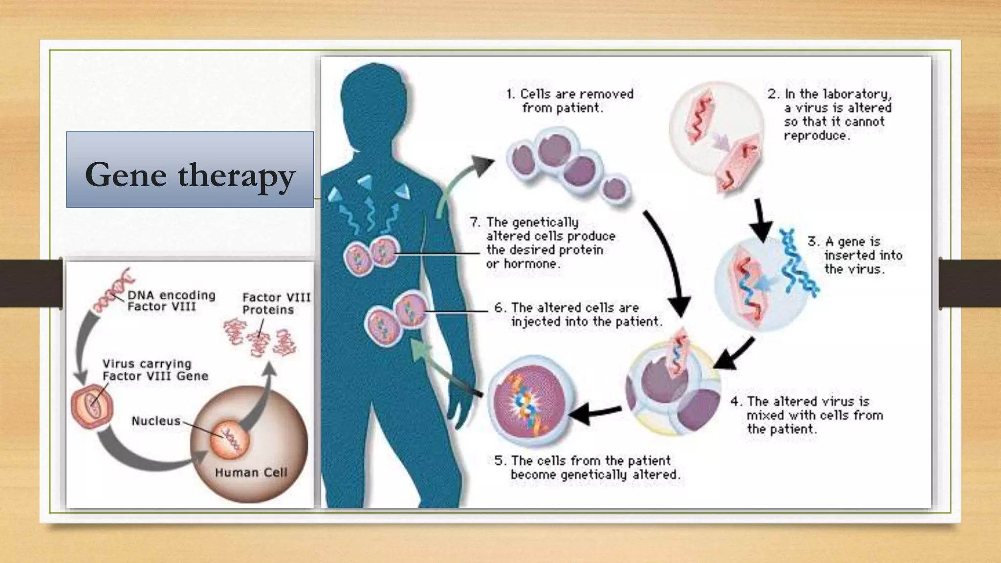 Gene therapy
 
