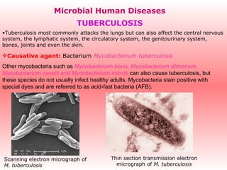 Microbial Human Diseases TUBERCULOSIS ,[object Object],[object Object],[object Object],Scanning electron micrograph of  M. tuberculosis   Thin section transmission electron micrograph of  M. tuberculosis 