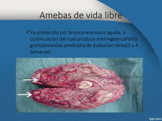 Amebas de vida libre 
Va predecida por bronconeumonía aguda, a 
continuación del cual produce meningoencefalitis 
granulomatosa amebiana de evolución lenta(3 a 4 
semanas). 
 
