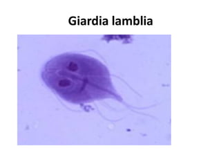 Giardia lamblia
 