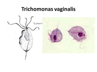 Trichomonas vaginalis
 