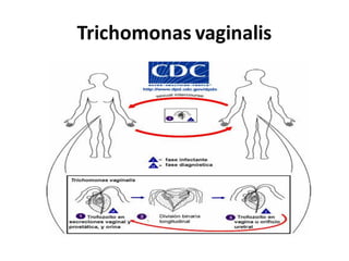 Trichomonas vaginalis
 