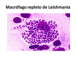 Macrófago repleto de Leishmania
 