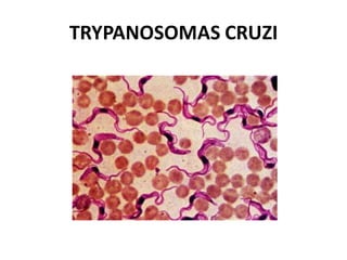 TRYPANOSOMAS CRUZI
 