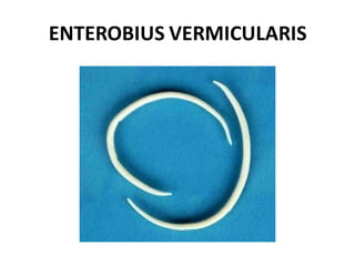 ENTEROBIUS VERMICULARIS
 