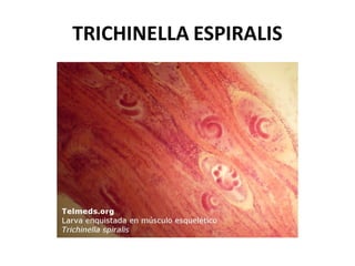 TRICHINELLA ESPIRALIS
 