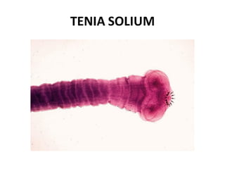 TENIA SOLIUM
 