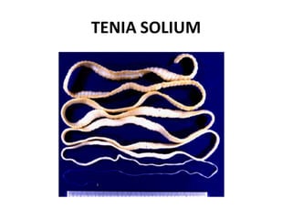 TENIA SOLIUM
 
