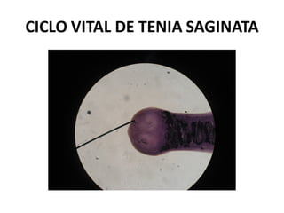 CICLO VITAL DE TENIA SAGINATA
 