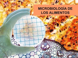 MICROBIOLOGÍA DE
LOS ALIMENTOS
 