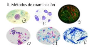II. Métodos de examinación
 