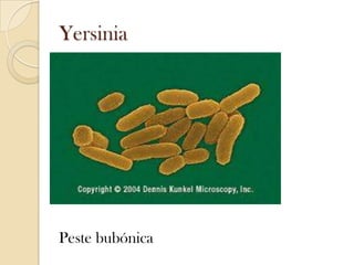 Yersinia

Peste bubónica

 