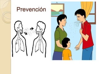 Prevención

 