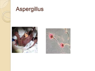 Aspergillus

 