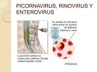 PICORNAVIRUS, RINOVIRUS Y
ENTEROVIRUS

 
