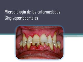 Microbiología de las enfermedades
Gingivoperiodontales

 